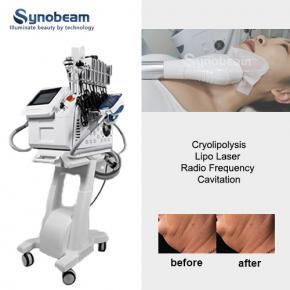 Desktop Multifunctional 360 Cryo For Body Slimming